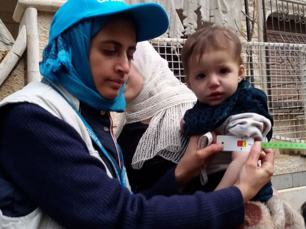 PHOTO: A photo released on Jan. 14, 2016 shows a UNICEF employee measuring the arm of a malnourished child in the besieged Syrian town of Madaya during an assessment of the health situation of residents of the famine-stricken town.