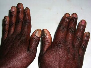 kenya domestic