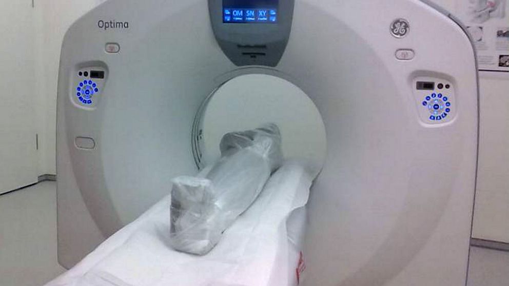 PHOTO: A mysterious mummy found in a German attic has kept experts busy for several weeks, and have finally determined its a fake.