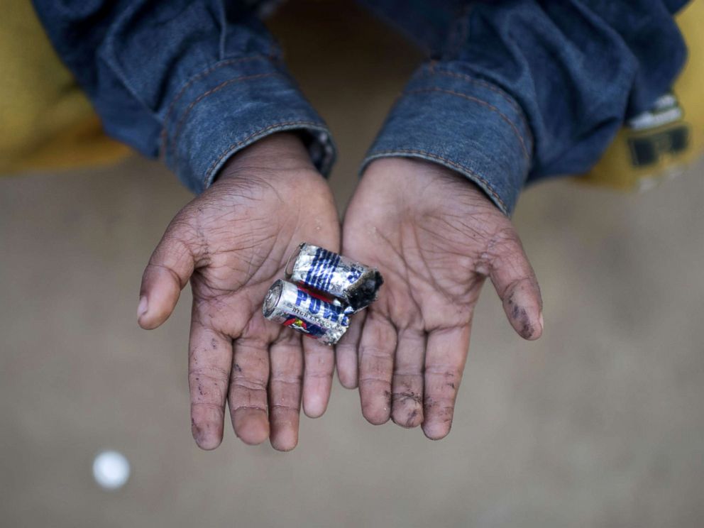PHOTO: Rohingya migrant boy Mohammad Shahed (4) holds a battery that he was playing with by dismantling it at Thankhali refugee camp in Coxs Bazar, Dec. 2, 2017.