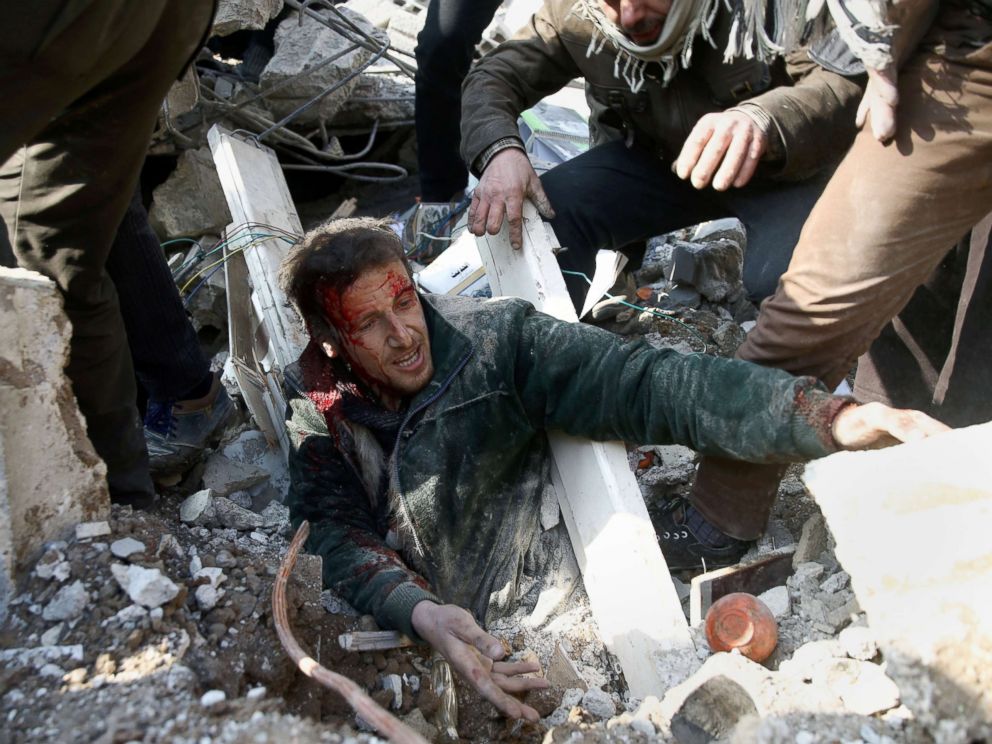 PHOTO: A man stuck under debris after an airstrike in the Saqba area, in the eastern Damascus suburb of Ghouta, Syria, Jan. 9, 2018. 