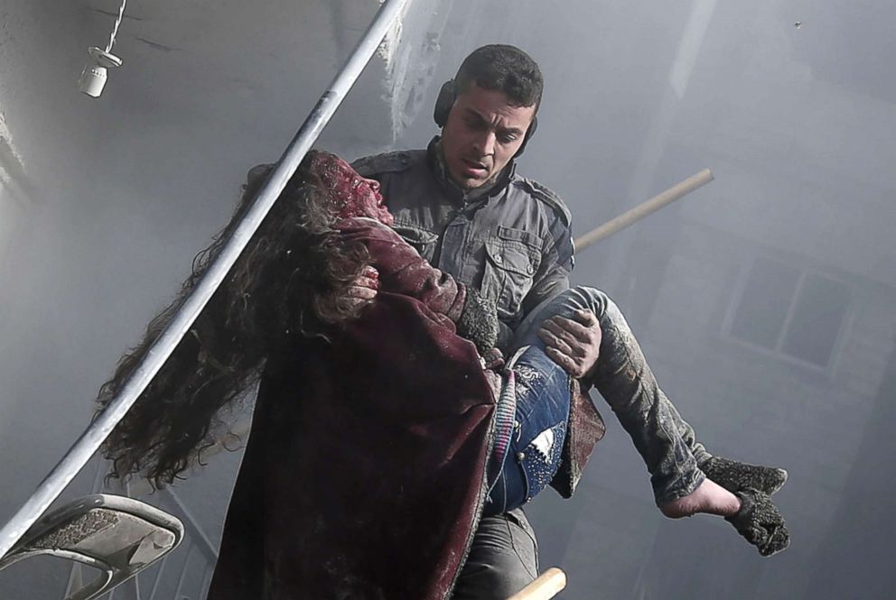 PHOTO: A volunteer from the Syrian Civil Defense, known as the White Helmets, carries a wounded girl after digging her out of the rubble following an air strike in the besieged rebel-held Eastern Ghouta area near Damascus, Syria, Jan. 9, 2018.