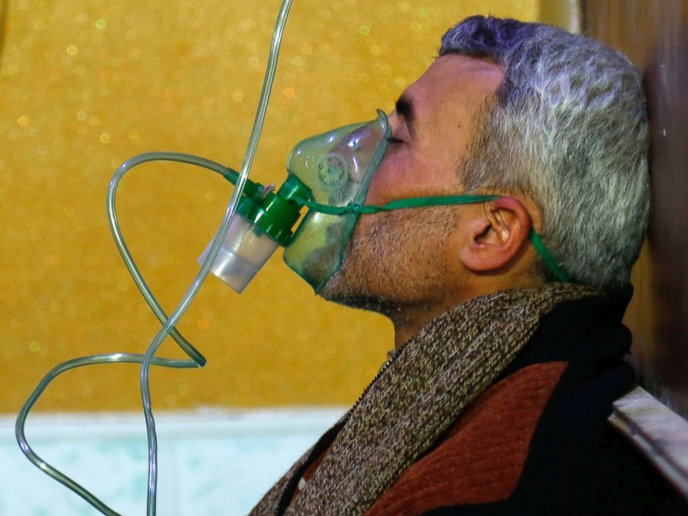 PHOTO: A Syrian man wears an oxygen mask at a makeshift hospital following a reported gas attack on the rebel-held besieged town of Douma in the eastern Ghouta region on the outskirts of the capital Damascus on Jan. 22, 2018. 