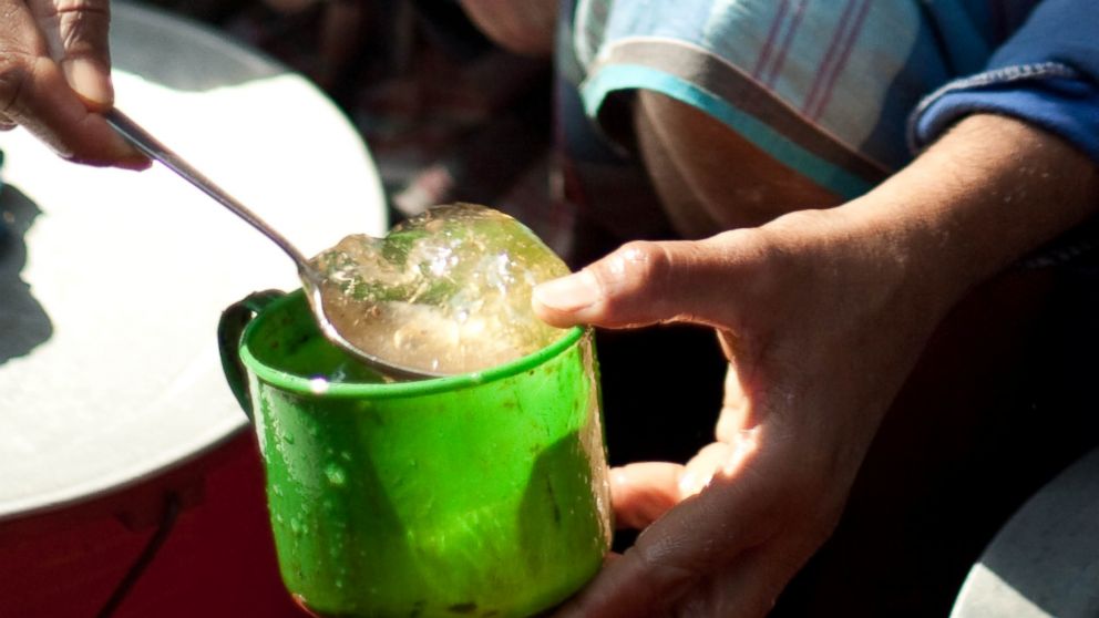 PHOTO: Health experts say aloe juice, long recognized for its health benefits, could save your skin this summer