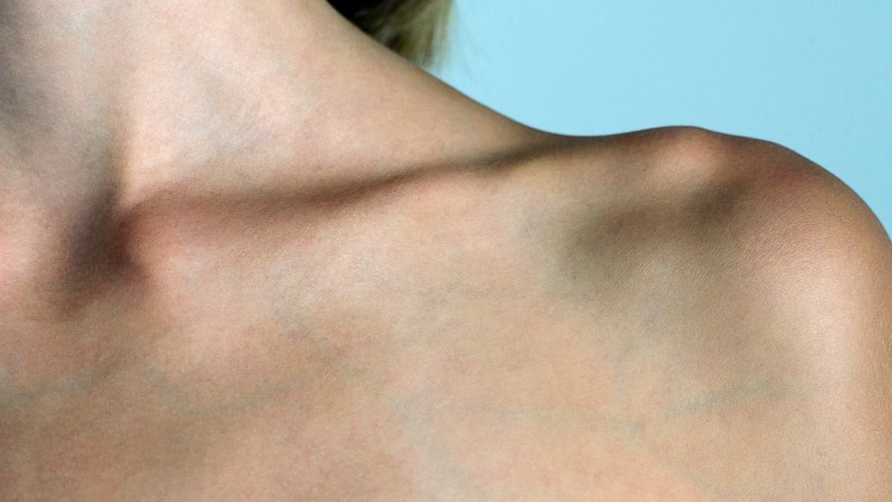 Is Your Collarbone Part Of Your Neck