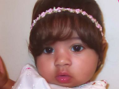 Does Your Bald Baby Need a Wig?