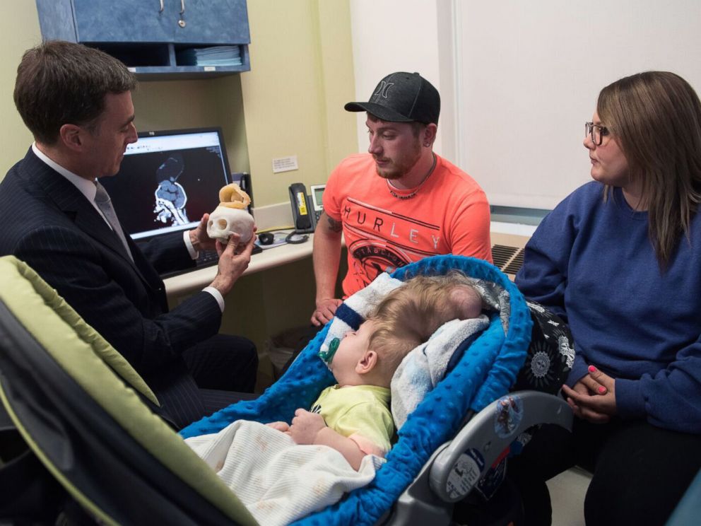 PHOTO: Bentley and his parents meet with Dr. John Meara, Plastic Surgeon-in-Chief, Boston Childrens Hospital. 