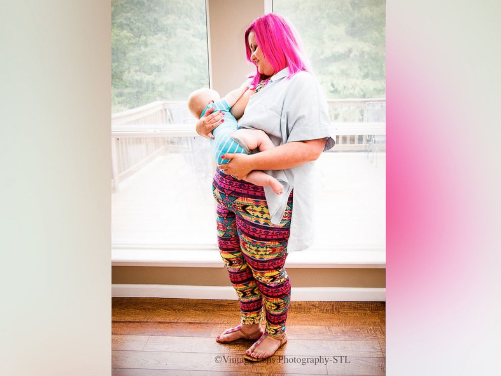 young-mother-diagnosed-with-breast-cancer-captures-last-time-breast