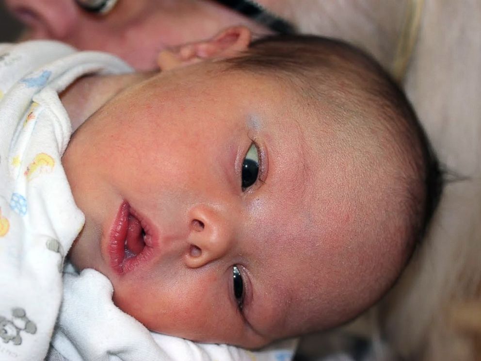 PHOTO: Leo Forrest was born with Down Syndrome.