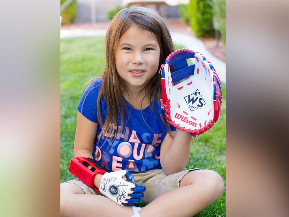 Girl with 3D prosthetic hand throws first pitch at World Series Girl with 3D prosthetic hand throws first pitch at World Series