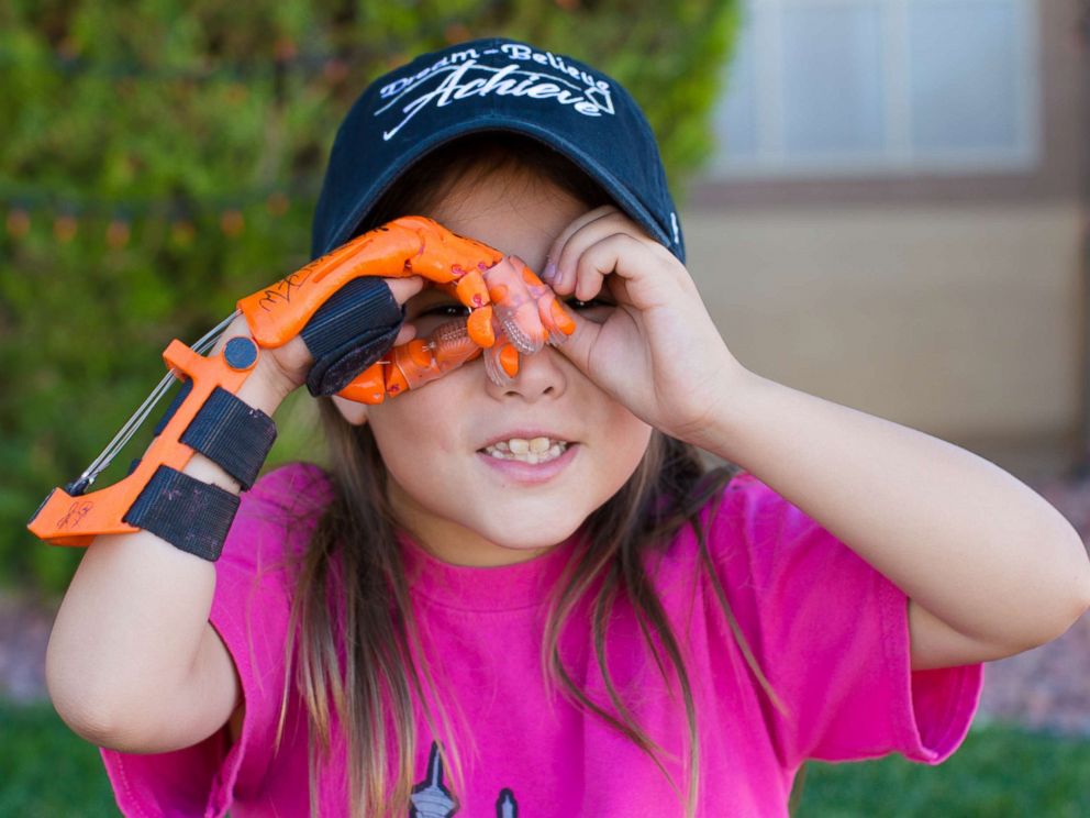 Girl with 3D prosthetic hand throws first pitch at World Series Girl with 3D prosthetic hand throws first pitch at World Series