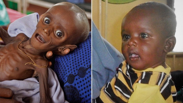 ... Notebook: Emaciated Somali Tot Now a Healthy, Chubby Toddler