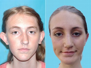 Bullied Teen Ready to Forgive Tormentors