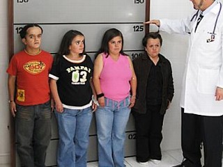 Photo: Dr. Jamie Guevara of the Ecuador Institute of Endocrinology measures the height of patients with Laron Syndrome or Laron Dwarfism.