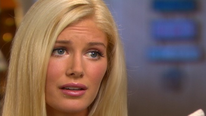 heidi montag before and after plastic surgery interview. Heidi Montag#39;s Plastic Surgery