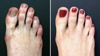 Photo: Are Toes the New Nose?