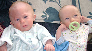 Photo: Baby Gets New Life After Reconstructive Surgery: Newborns Misshapen Forehead Could Have Hurt His Development