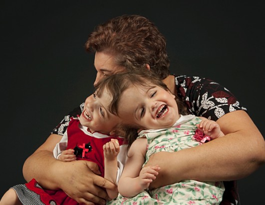 Twins Who Share A Brain