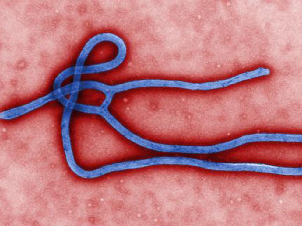 PHOTO: An Ebola virus is shown in this undated file image by the CDC.