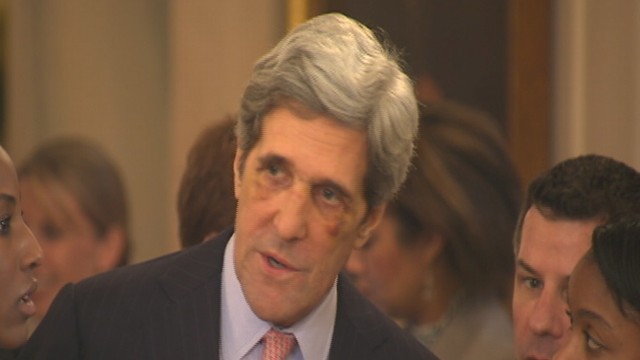 VIDEO: Sen. John Kerry Sports Black Eyes at White House