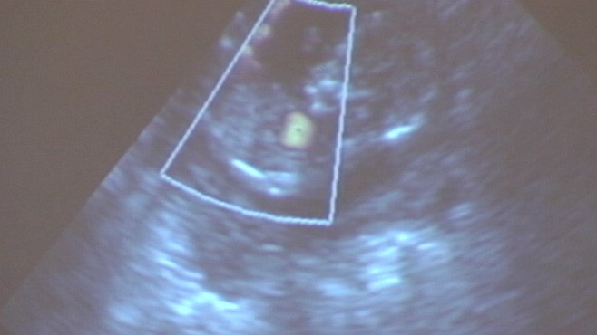 VIDEO: Ohio lawmakers consider so-called "heartbeat" bill to ban abortion.