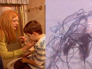 Morgellons