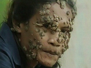An Out-of-Control Virus