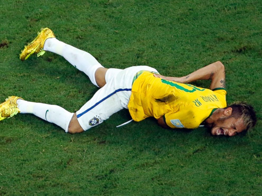 PHOTO: Brazils Neymar grimaces in pain during the World Cup quarterfinal soccer match between Brazil and Colombia at the Arena Castelao in Fortaleza, Brazil, Friday, July 4, 2014. Brazils team doctor says Neymar will miss the rest of the World Cup.