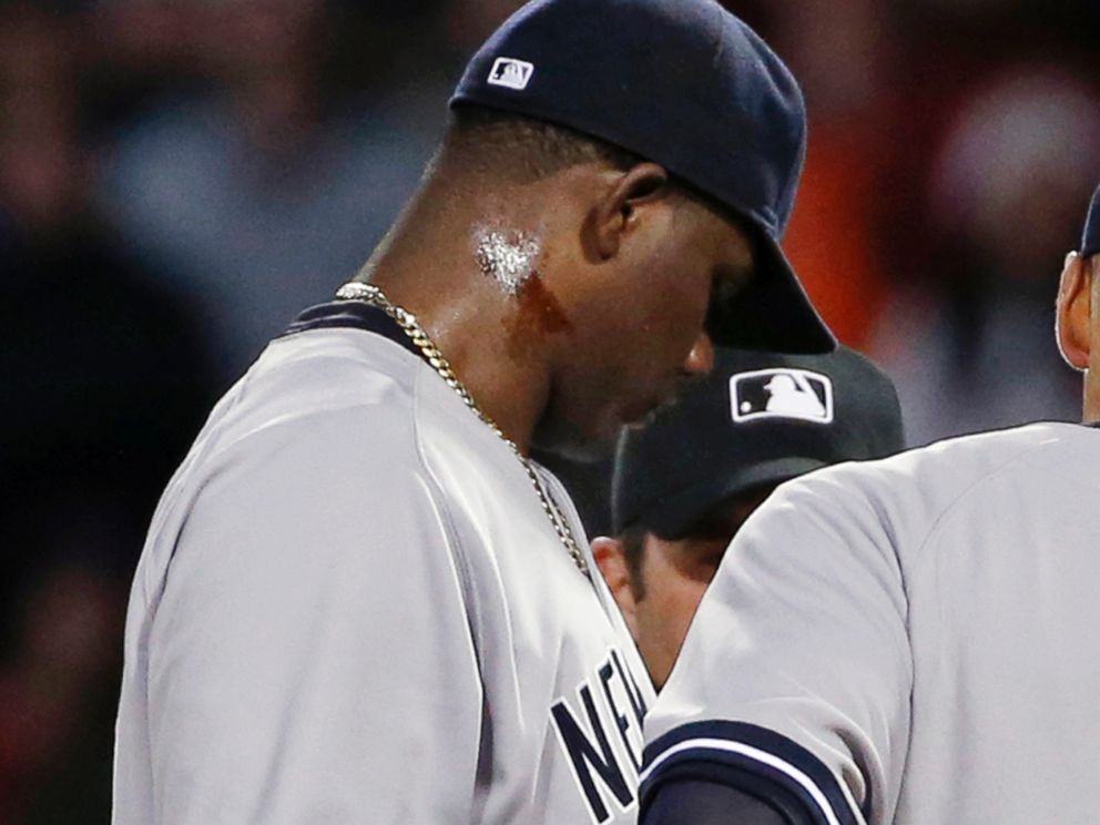 PHOTO: A substance can be seen on Yankees pitcher Michael Pinedas neck, April 23, 2014.