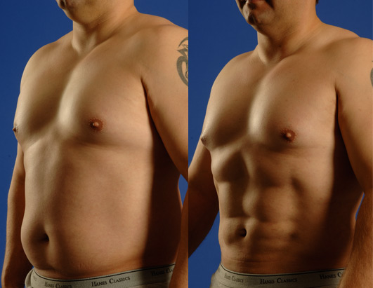 abs3 abs3