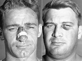 The Bad Old Days of Football