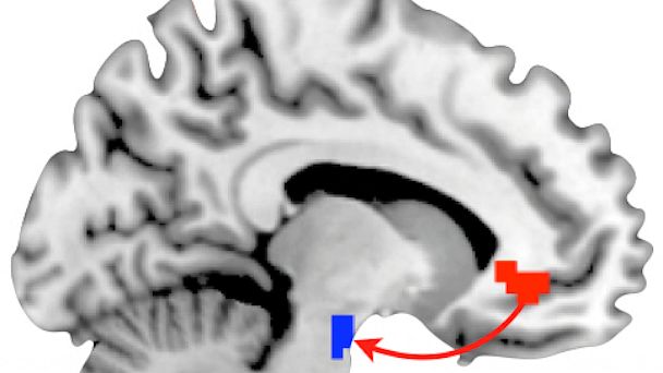 PHOTO: Brain Scan Personality Traits