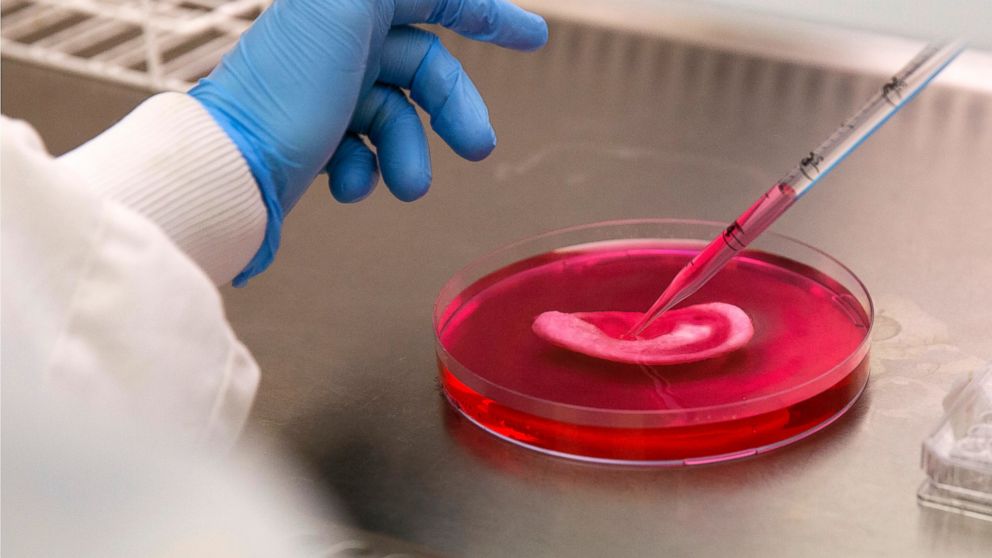 PHOTO: Dr Michelle Griffin, a plastic research fellow, demonstrates for photographs seeding stem cells onto a synthetic polymer ear at her research facility in the Royal Free Hospital in London, March 31, 2014.