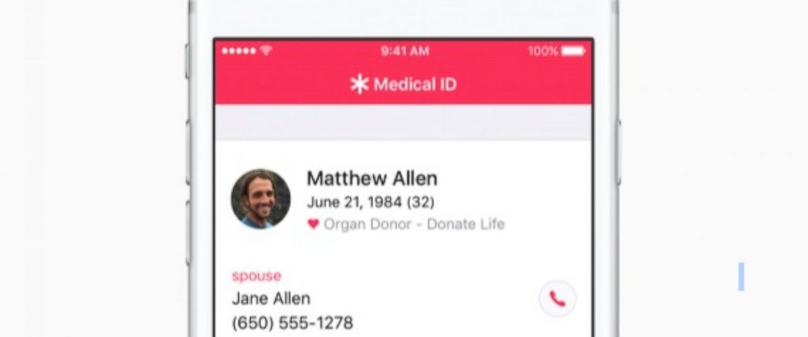 The best option for a donor organ would be