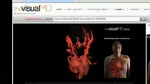 VIDEO: Visual MD Offers Intense 3D Imagery