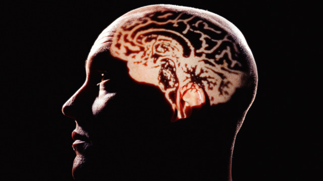 PHOTO: Human brain