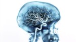 PHOTO: IBM scientists are researching how to link your brain to your devices, such as a computer or a smartphone.