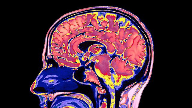 PHOTO: Researchers report new findings on how the human brain retains what is most important, and avoids being overwhelmed by trivia.