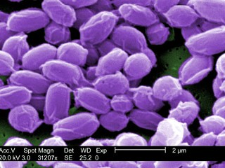 Anthrax may be tough, but it gets sick, too