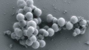 Photo: First Cell Controlled by Synthetic Genome