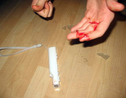 Wii Accidents 