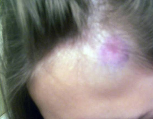 Wii Accidents 