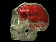 Hobbit Brain 