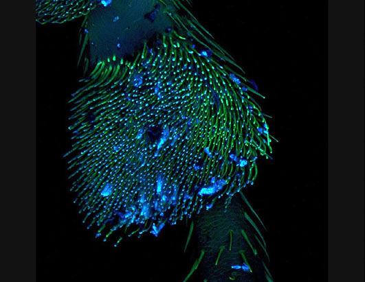 Photo Winners from Nikons Small World Contest