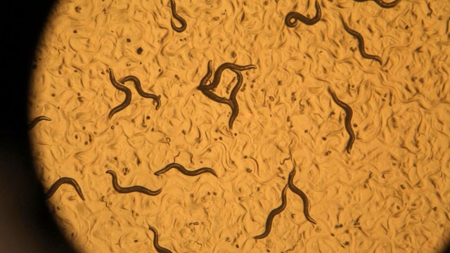 PHOTO: By studying the roundworm, Dr. Cynthia Kenyon and her team have pinpointed a combination of rare genes that seem to counter the effects of aging.