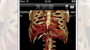 Featured in Apples commercials, OsiriX allows radiologists to view and carry around their patients X-ray scans on an iPhone.