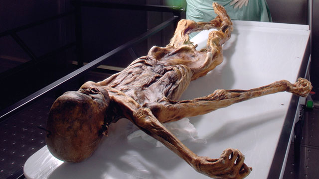 PHOTO: German scientists are helping decode the genome of the 5,300-year-old Tyrolean iceman, found in 1991 in the Alps close to the border between Austria and Italy.