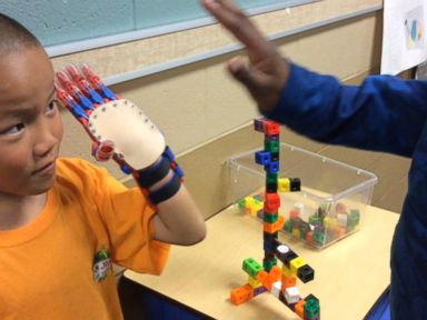 WATCH: Fifth-graders use the latest technology to change a fellow classmate's life
