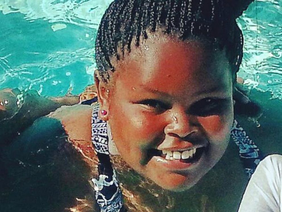 PHOTO: Jahi McMath remains on life support at Childrens Hospital Oakland nearly a week after doctors declared her brain dead.