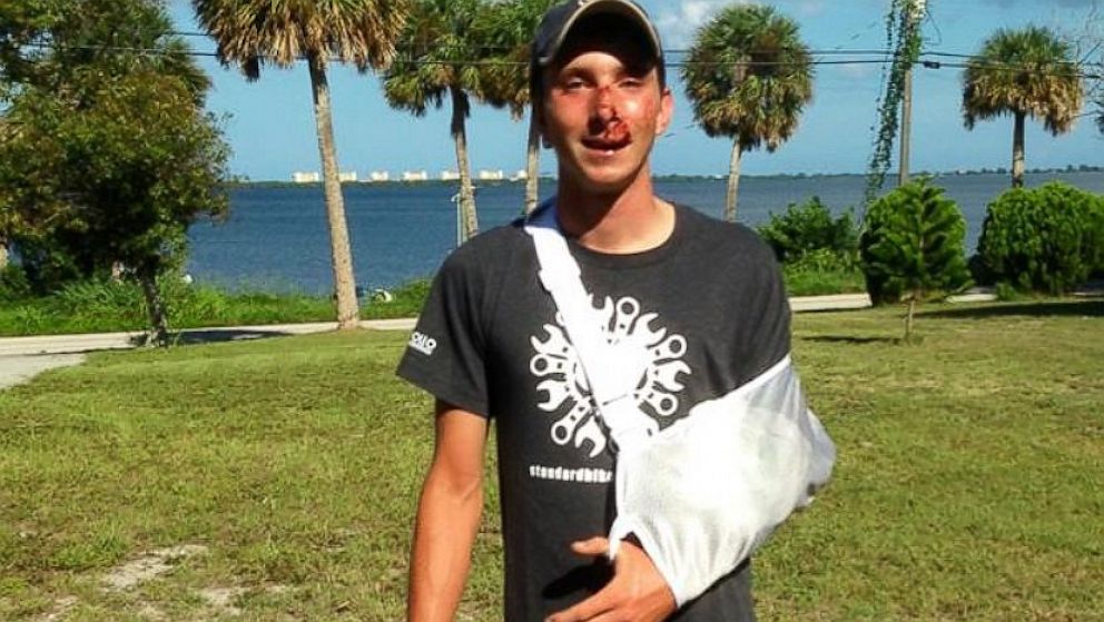 PHOTO: Jacob Landis pictured after the accident.